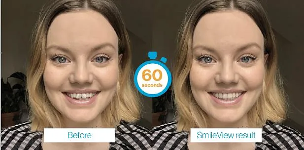 Before and after 